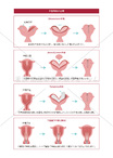 子宮奇形の治療　子宮形成術
