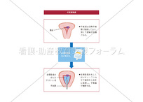子宮鏡検査（ヒステロスコピー）