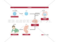 胚細胞腫瘍の発生と分類
