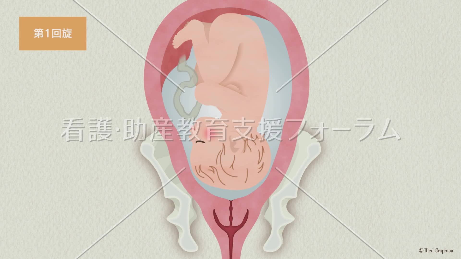 正常分娩における胎児の回旋～児が第1胎向の例～
