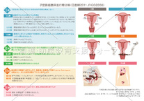 子宮頚癌の進行期分類（日産婦2011、FIGO2008)