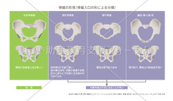 骨盤の形態（骨盤入口の形による分類）