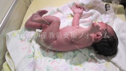 出生直後の新生児